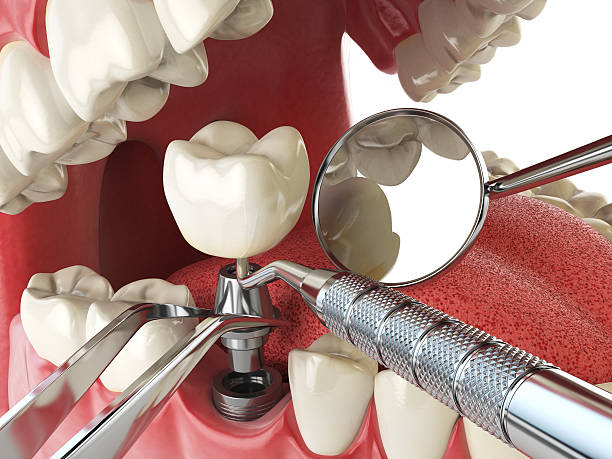 Best Emergency Dental Care for Abscessed Tooth in Whitewright, TX